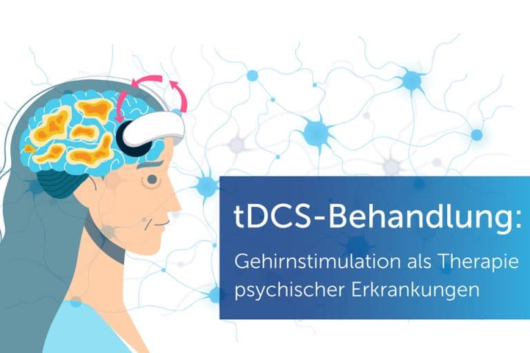 tDCS Behandlung